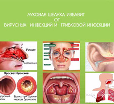 ИЗБАВЛЯЕМСЯ от вирусных и грибковых инфекций И НЕ ТОЛЬКО