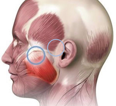 Гипертонус жевательных мышц: на ЧТО влияет и КАК избавиться
