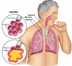 Как очистить легкие?