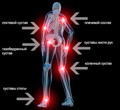 Подпороговая боль: как распознать заболевание суставов на ранней стадии