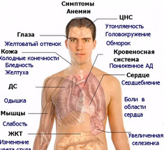 Тревожные симптомы дефицита витамина В12 в организме