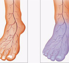 Как улучшить кровообращение в ногах за 20 дней: 7 советов