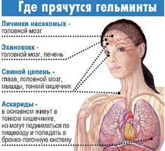 Как избавиться от паразитов: советы Аюрведы