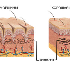 Как стимулировать выработку коллагена с помощью натуральных средств