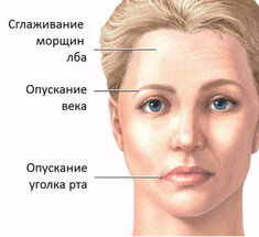 3 упражнения для КОРРЕКЦИИ асимметрии ЛИЦА