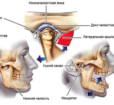 Лечение ВНЧС: миогимнастика Рокабадо