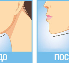 Избавляемся от двойного подбородка: экспресс-метод Мамада Йошико