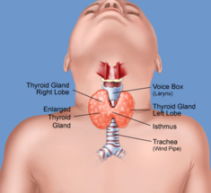 Заболевания ЩИТОВИДНОЙ ЖЕЛЕЗЫ у детей: Тревожные признаки