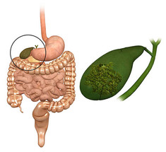 Желчный пузырь: Первые симптомы заболевания