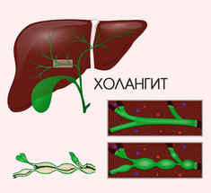 Болезни желчевыводящих путей: чем грозит и что делать