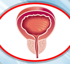 Увеличение простаты: Что необходимо знать ВСЕМ мужчинам старше 35