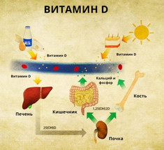 ТОП-5 признаков дефицита витамина D