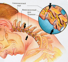 Хрустит шея и болит голова: Что делать?