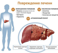 Проверьте печень: экспресс-тест на обнаружение проблем