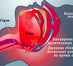 Как избавиться от храпа: простые упражнения по советам ЛОР-врача