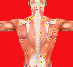 Что такое точки напряжения в мышцах и как их лечить