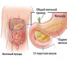 Холестаз: эффективные средства при застое желчи