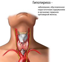 Истинный гипотиреоз и соматические заболевания