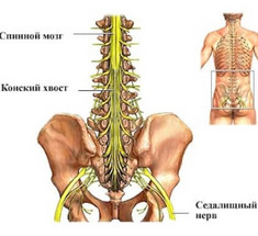 Синдром конского хвоста: Когда надо бить тревогу