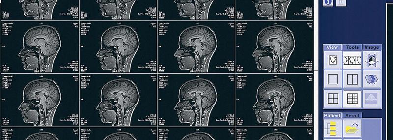 История о том, как учёные искали речь в голове журналиста 