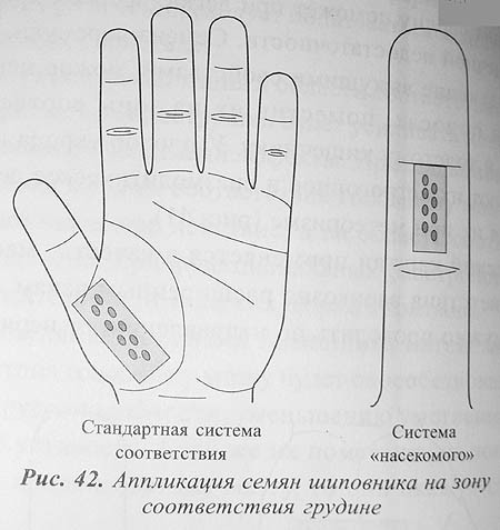 Использование внутренних лекарственных свойств растений для су-джок семянотерапии