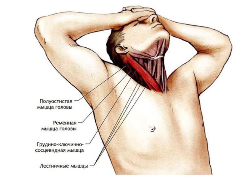 Как проявляется синдром передней лестничной мышцы и к чему приводит? 