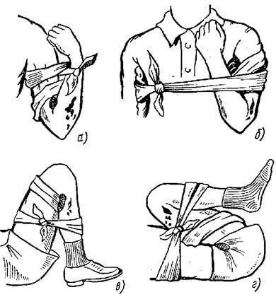 Приемы и способы остановки кровотечений, правила наложения повязок про ранениях