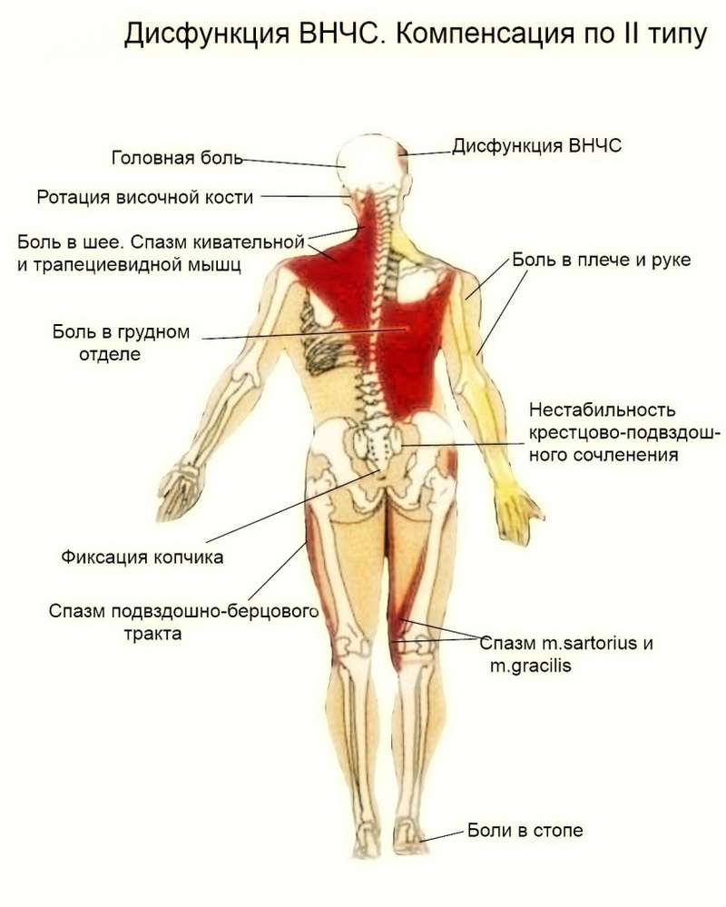 Болит голова — проверьте прикус!