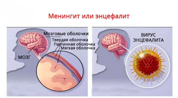 Педиатр Григорий Шеянов: Как распознать у ребенка неотложное состояние