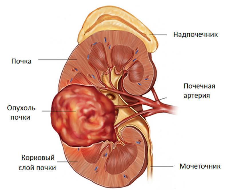 Это нужно знать! Почки никогда вдруг не отказывают