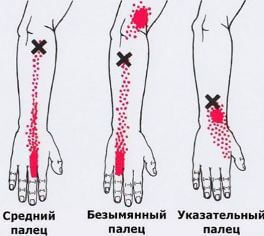 Триггеры: Карта точек боли и напряжения в теле 