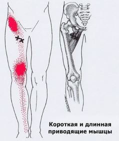 Триггеры: Карта точек боли и напряжения в теле 