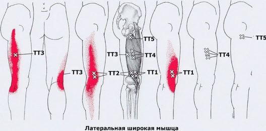 Триггеры: Карта точек боли и напряжения в теле 