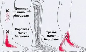 Триггеры: Карта точек боли и напряжения в теле 