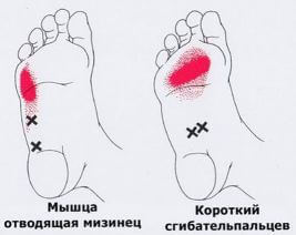 Триггеры: Карта точек боли и напряжения в теле 