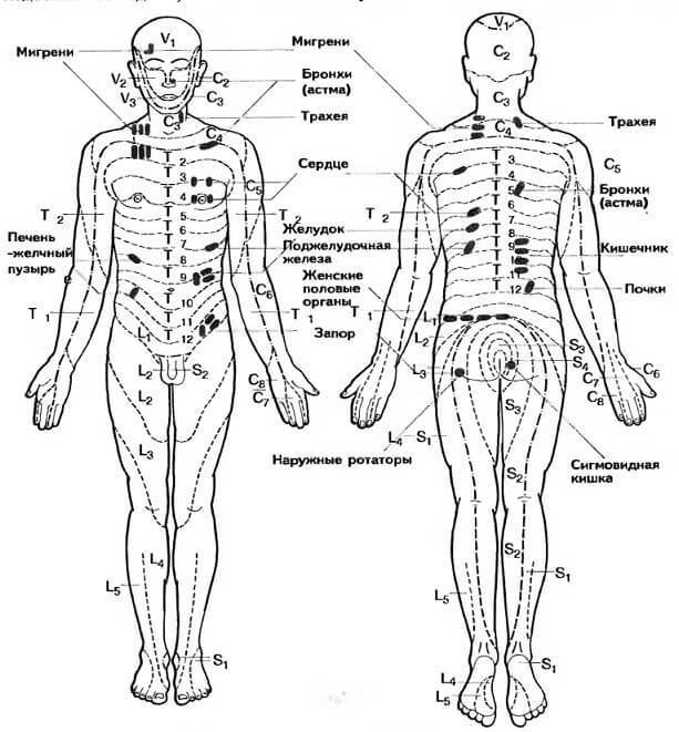 Определение триггерных точек на теле