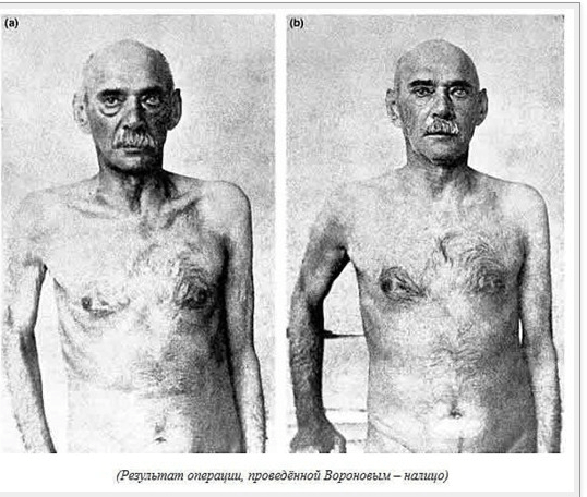 Профессор Преображенский в реальности