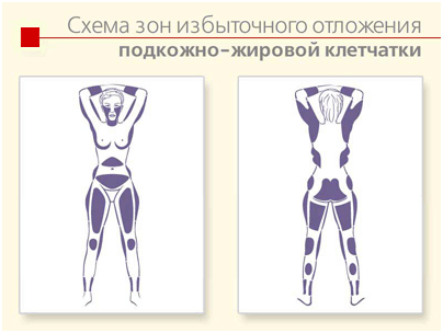 Подкожный жир: нет жира – нет изобилия