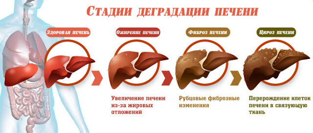 Сахар и алкоголь: недружелюбные близнецы