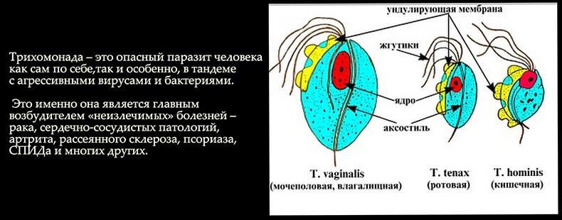 Трихомонадная теория рака Тамары Свищевой