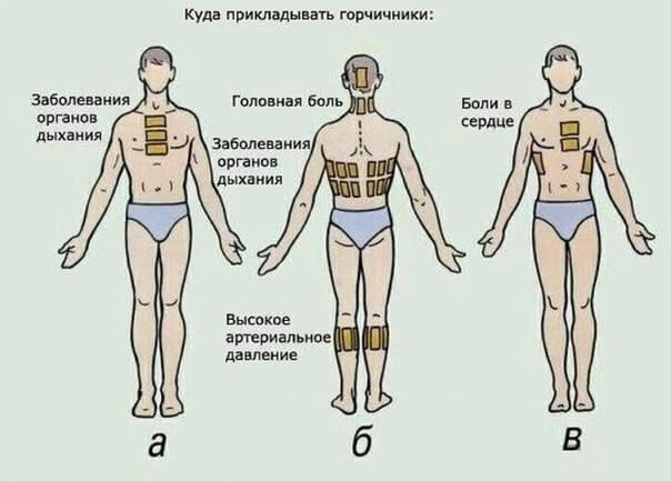 Простое средство для лечения гипертонии, мигрени и межреберной невралгии