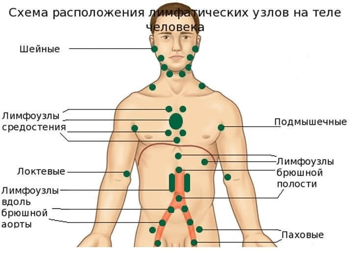 Лимфаденит: 80% того, что мы делаем, вредит нашему здоровью