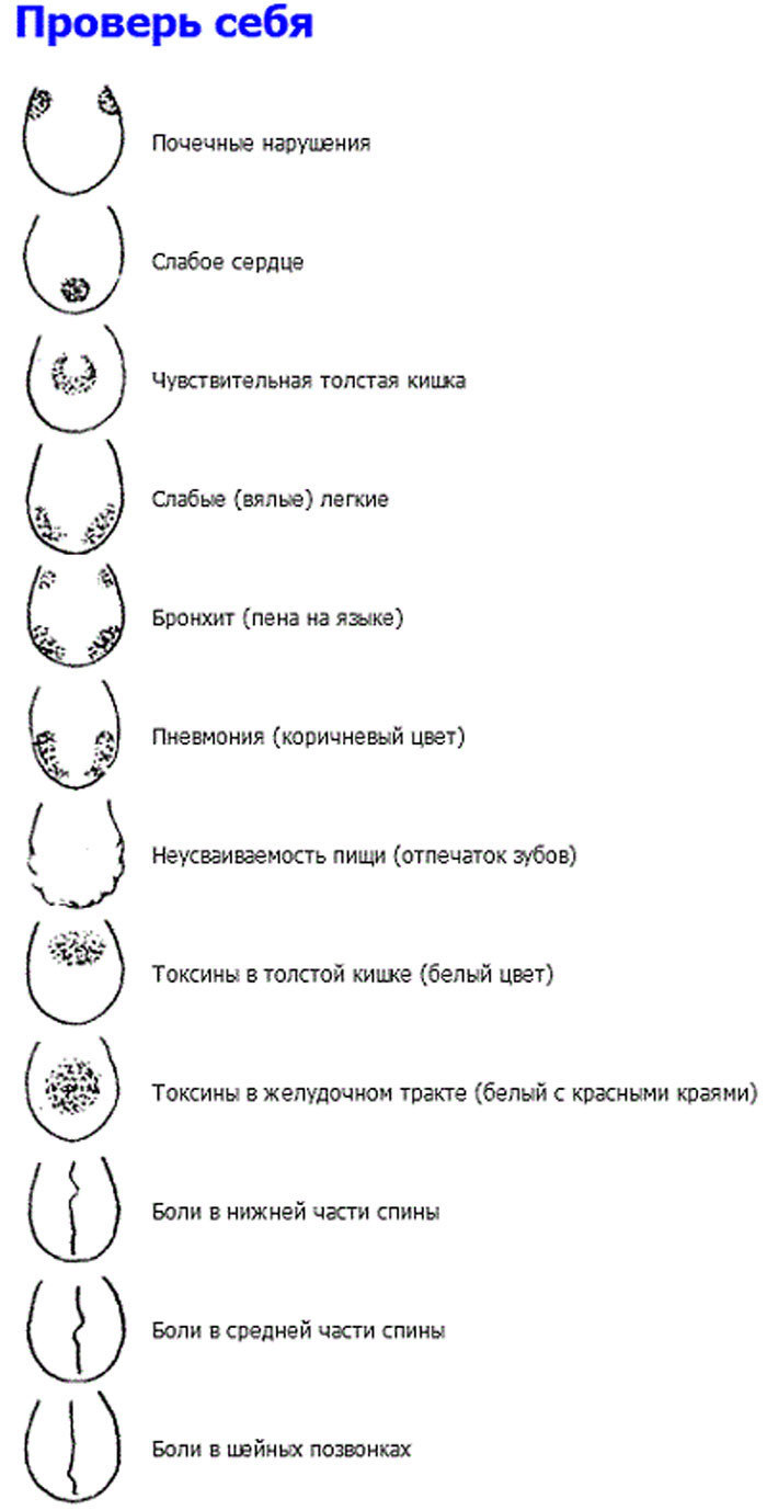 Проверьте себя! Язык расскажет о проблемах в организме