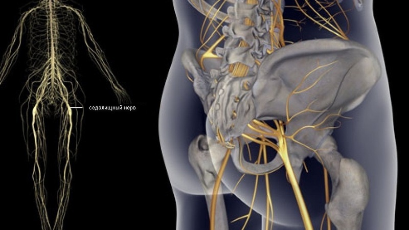 1 упражнение, которое реально избавляет от болей в пояснице! Приструните седалищный нерв