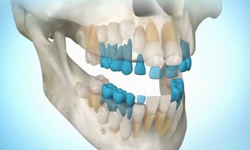 СЕНСАЦИЯ! Теперь вырастить зубы станет возможным в любом возрасте