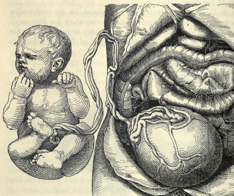 Пережатие пуповины: памятник гинекологической глупости