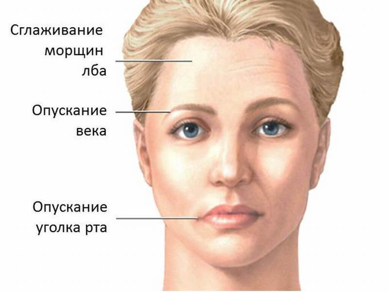 3 упражнения для КОРРЕКЦИИ асимметрии ЛИЦА