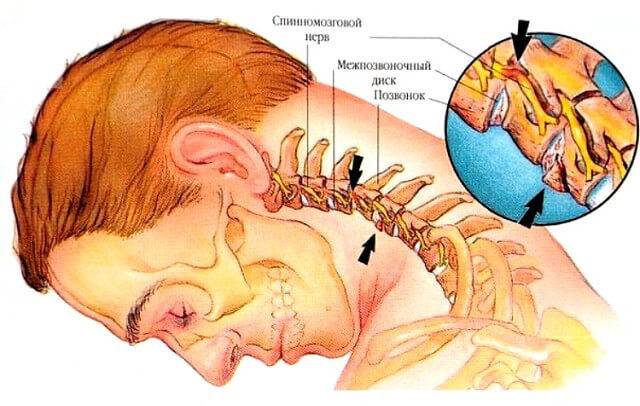 9 упражнений из восточной медицины для снятия боли в шее