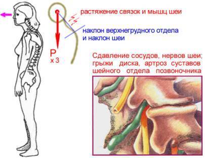 ГИГИЕНА ОСАНКИ: Воспитание и Коррекция