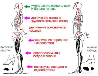 ГИГИЕНА ОСАНКИ: Воспитание и Коррекция